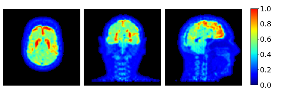 Positron-emission-tomography